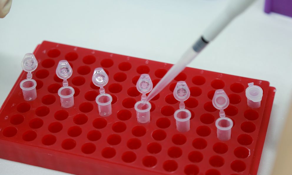 Mang mẫu tóc con trai đi xét nghiệm ADN: Chưa kịp vui đã phải sốc nặng vì điều này