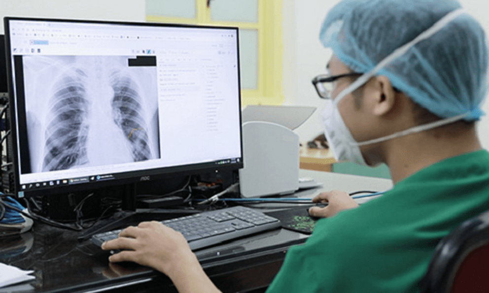 AI đọc phim X-quang, giám định bảo hiểm y tế: Bác sĩ có bị thay thế?