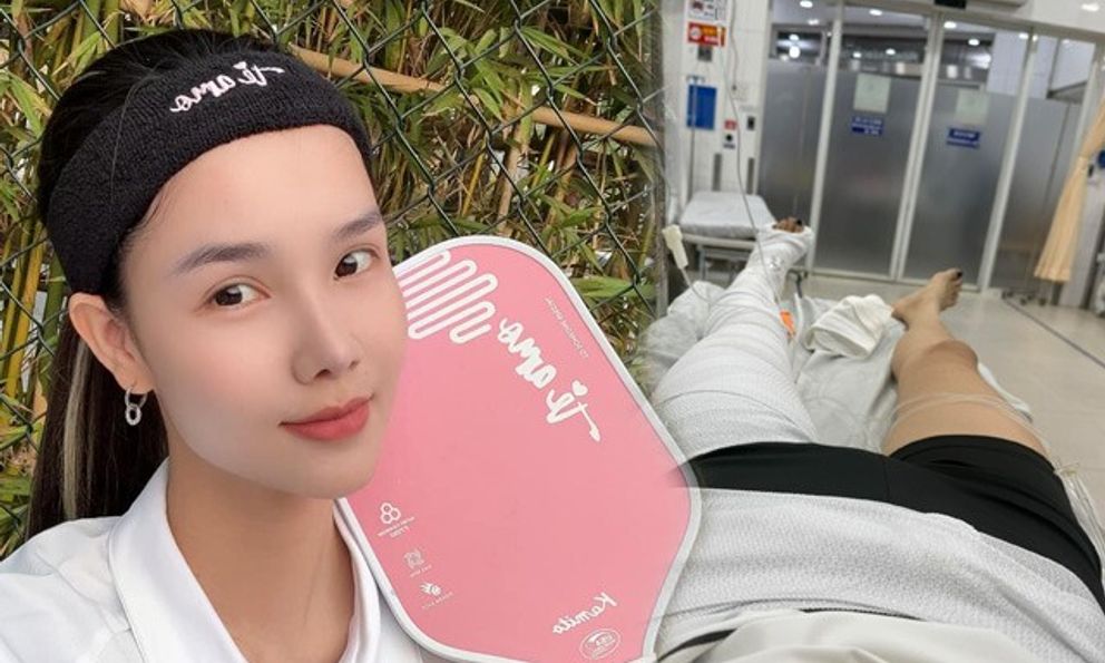 Từ vụ sao nữ Vbiz gãy xương đùi khi chơi pickleball, chuyên gia chỉ ra 4 lỗi sai cực nguy hiểm