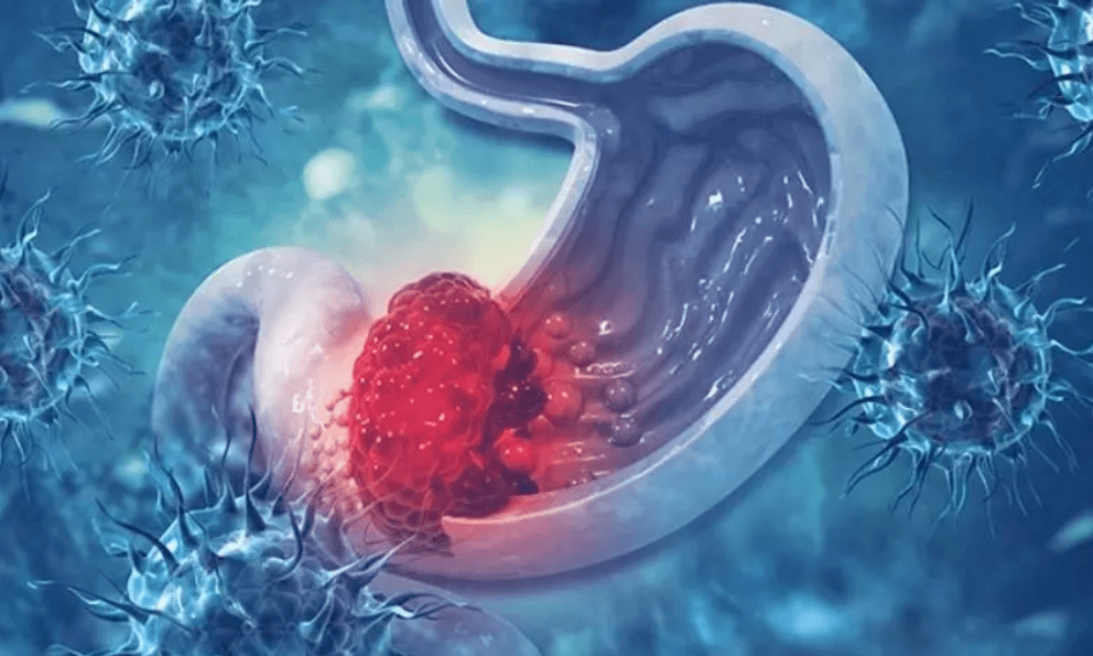 Mắc ung thư giai đoạn cuối, người phụ nữ Hà Nội làm 1 việc, khiến bác sĩ thốt lên 