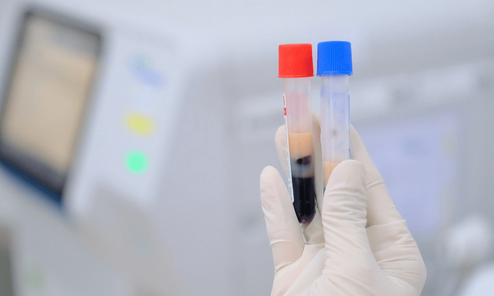 Mê mẩn loại đồ uống này, nhiều người Việt nhận hậu quả nghiêm trọng, máu trắng đục như sữa