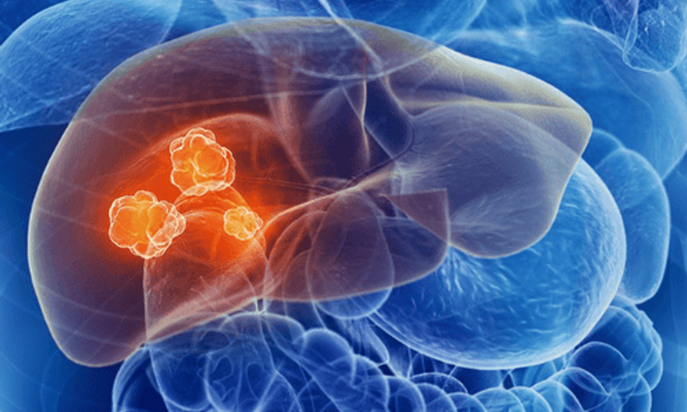 Bác sĩ cảnh báo 1 thứ âm thầm 