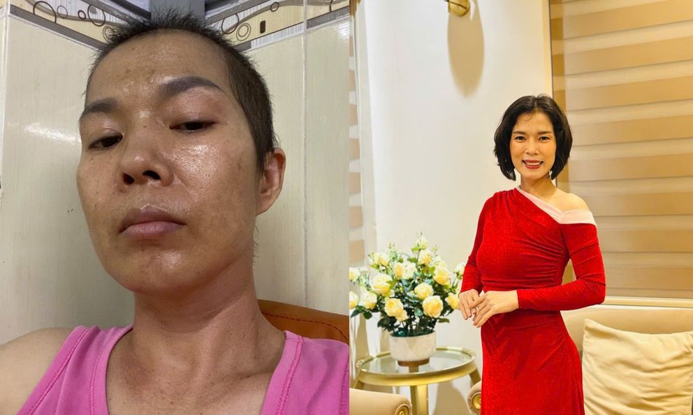 Phát hiện ung thư giai đoạn 3 đã di căn, 1 năm sau làm được điều không ai nghĩ tới: Tất cả nhờ vào 2 việc