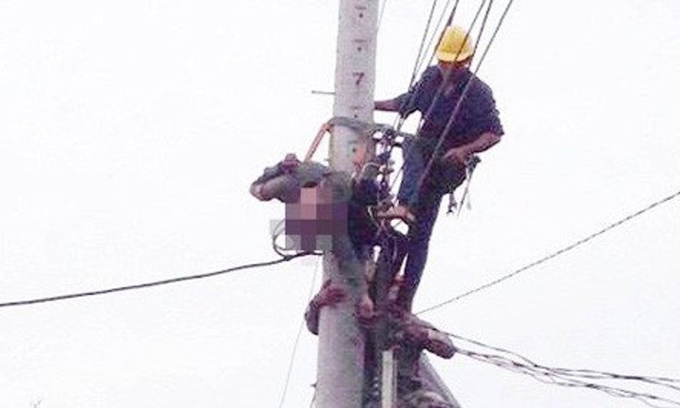 Cứu 2 công nhân ngưng tim, ngừng thở do điện giật