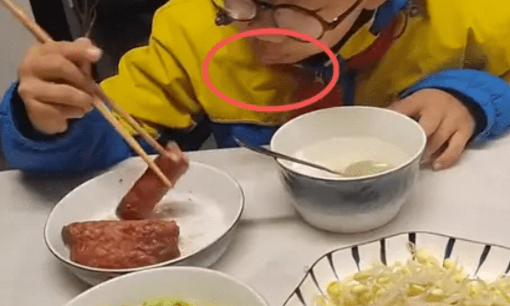 Bức ảnh ăn sáng khiến cư dân mạng tranh cãi: Nhìn môi đứa trẻ đi bố mẹ ơi, đang có vấn đề kìa!