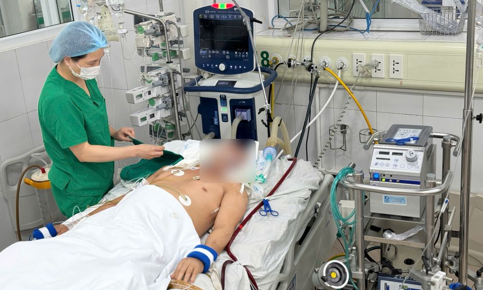 Cảnh báo sốt xuất huyết gây nguy kịch ở người trẻ: 13 ngày cứu sống nam thanh niên 23 tuổi suy hô hấp, phải chạy ECMO
