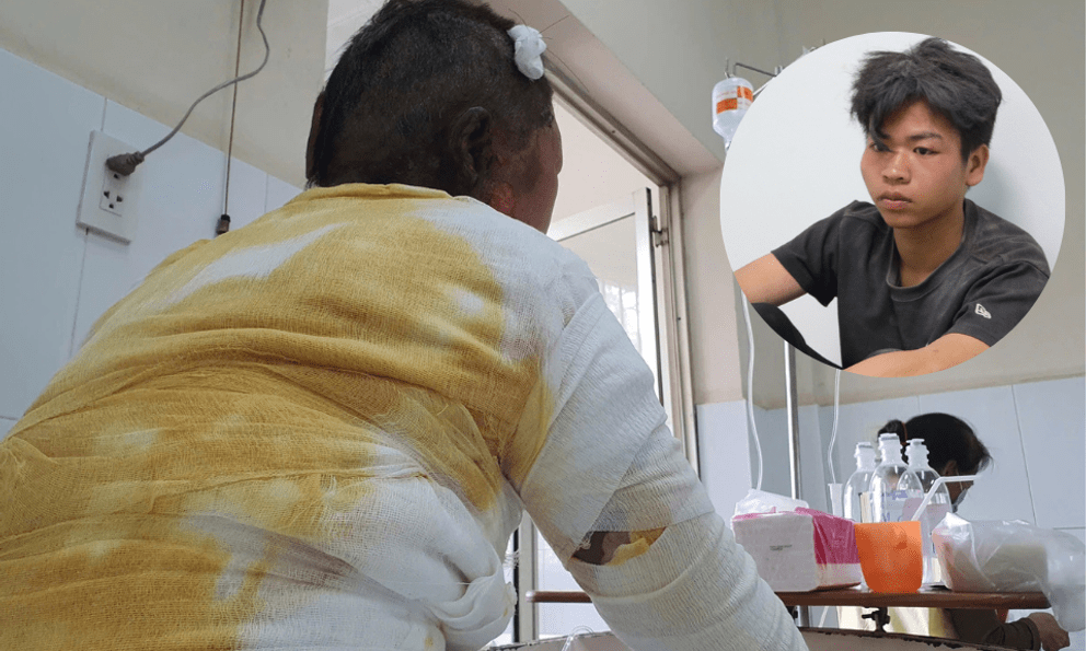 Người mẹ nguy kịch vì bị con trai tạt xăng dã man: 