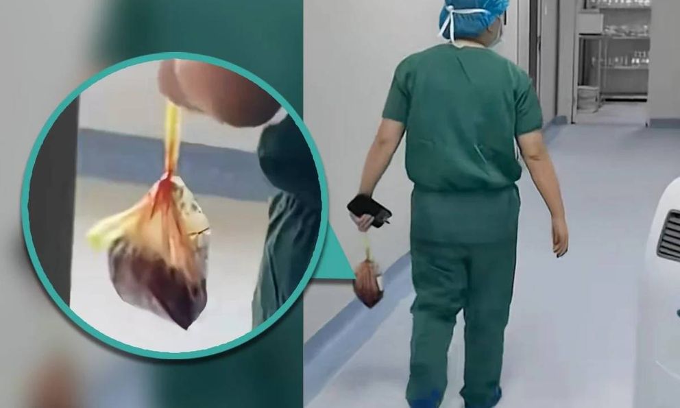 Bức ảnh bác sĩ cầm theo chiếc túi nilon đi giữa hành lang khiến nhiều người rùng mình