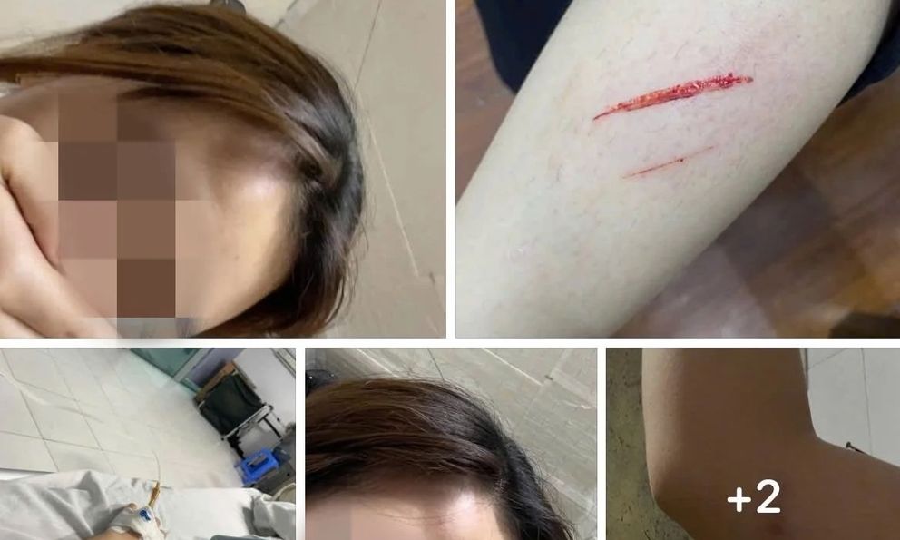 Tình hình sức khoẻ hiện tại của nữ sinh bị đánh nhập viện vì mâu thuẫn 