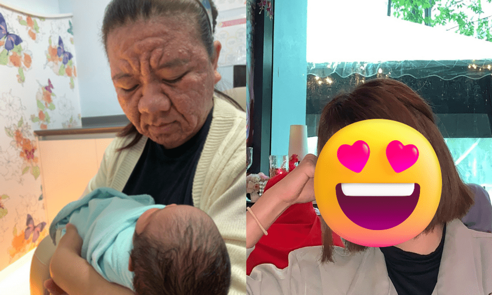 Xót xa gương mặt biến dạng sau khi mang thai của người mẹ trẻ, nhìn lại nhan sắc xinh đẹp trước đó càng không dám tin