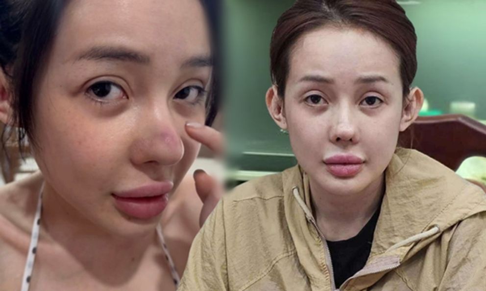 Ngân 98 và những cú lộ mặt mộc gây sốc tâm lý