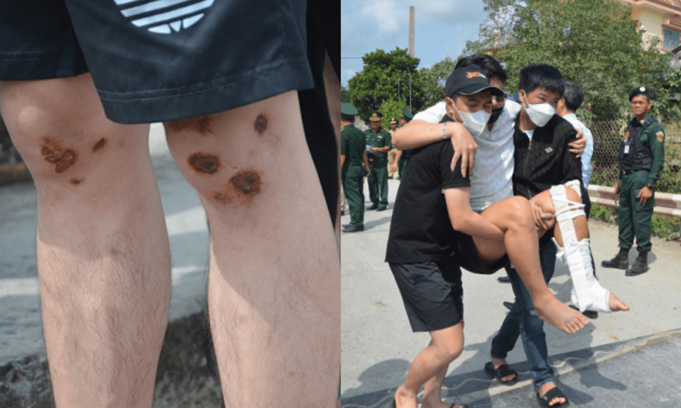 Nam thanh niên rùng mình kể lại phút kinh hoàng khi làm việc ở Campuchia: Bị giam lỏng, chích điện bỏ đói, đòi 5.000 USD chuộc