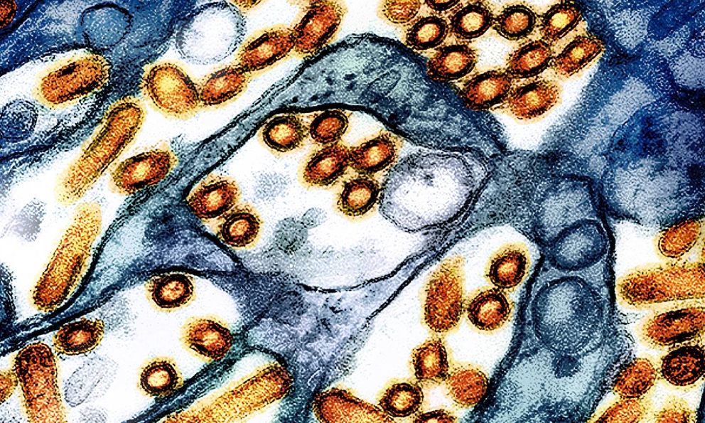 Phát hiện chủng virus cúm gia cầm chưa từng thấy ở người tại Mỹ
