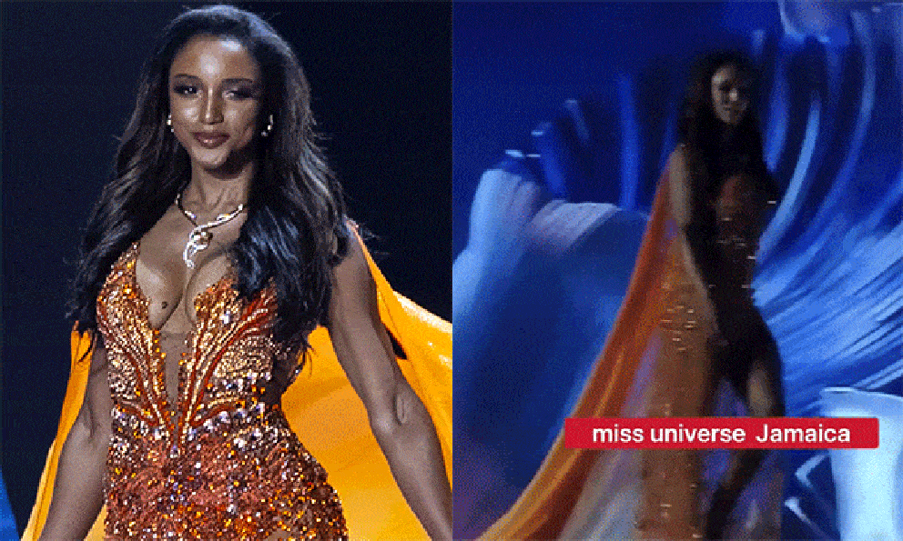 Tình trạng của thí sinh Hoa hậu Hoàn vũ ngã lọt hố, phải nằm phòng ICU