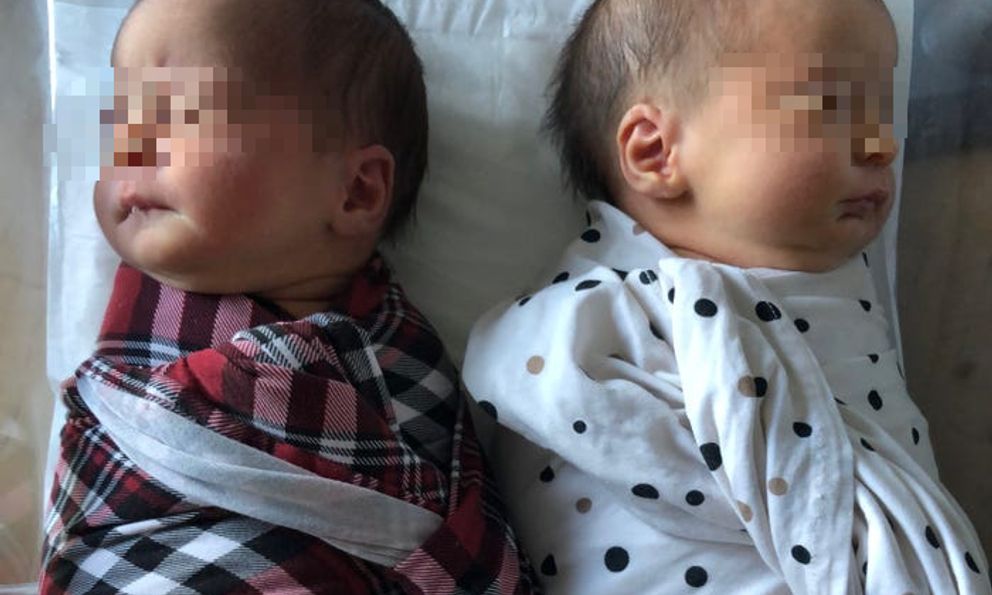 Xét nghiệm ADN, người phụ nữ bàng hoàng phát hiện 2 con sinh đôi của mình không cùng cha 
