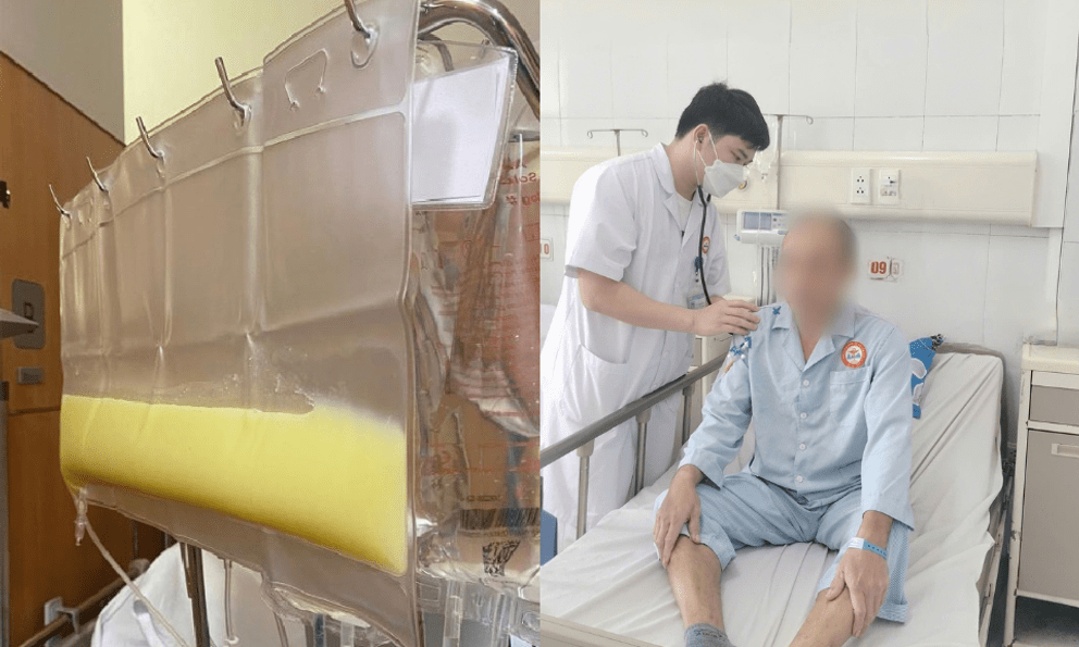 Huyết tương đục như mỡ, người đàn ông nguy kịch vì uống nửa lít rượu mỗi ngày