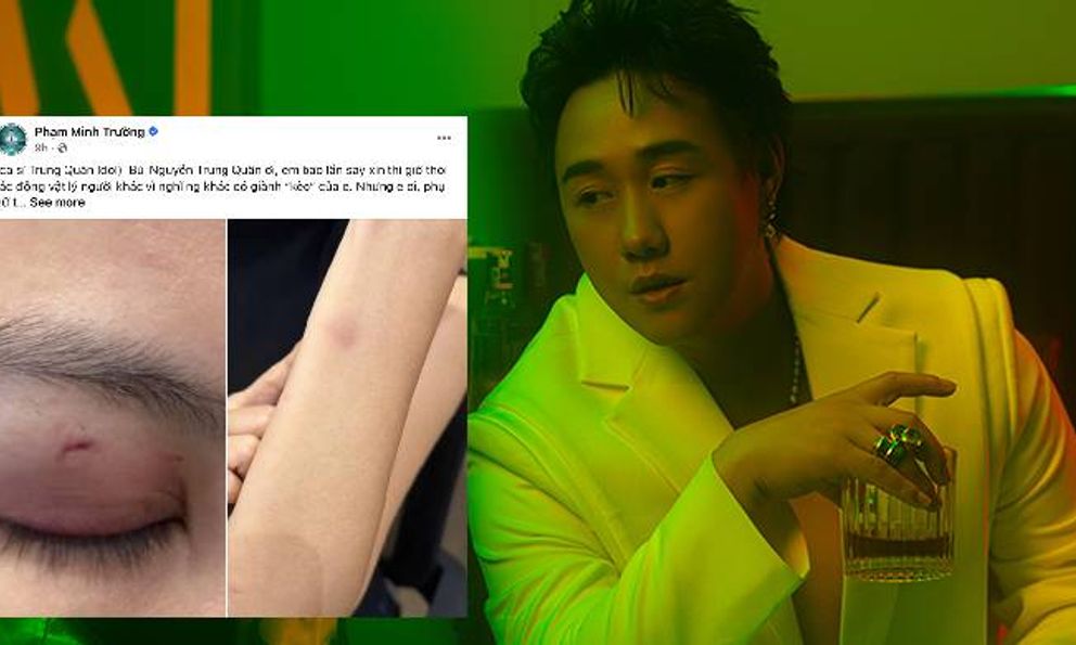 Nóng: Công an vào cuộc vụ ca sĩ Trung Quân Idol bị tố hành hung phụ nữ ở TPHCM