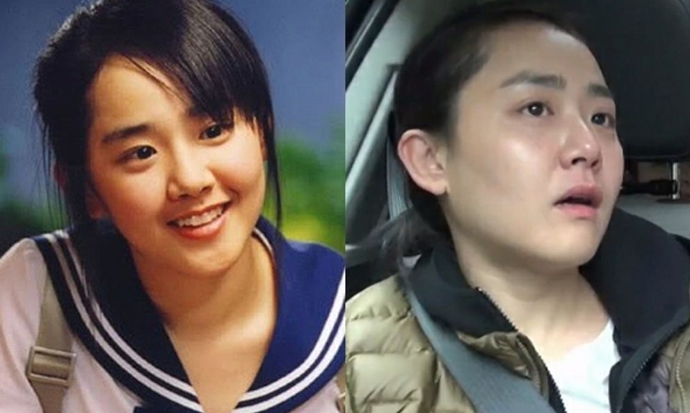 Moon Geun Young trượt chân ngã đi khám ra bệnh quái ác: Bị chẩn đoán sai, trốn trong hầm gửi xe khóc nức nở 1 mình 