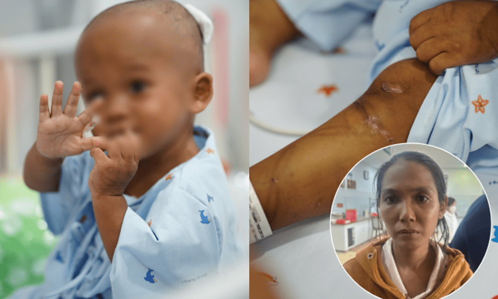 Hình ảnh xúc động của bé trai 2 tuổi bị bạo hành: Đã biết cười, chơi đùa trở lại nhưng phải theo dõi dập phổi
