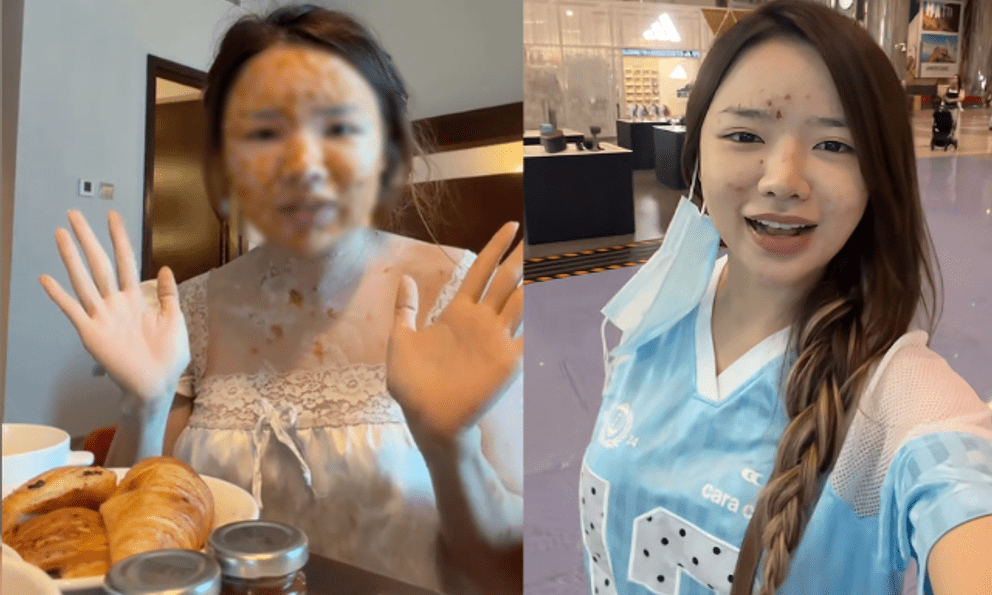 Sau gần nửa tháng cách ly tại Dubai vì mắc thủy đậu, TikToker Việt cập nhật tình trạng hiện tại khi qua cửa hải quan
