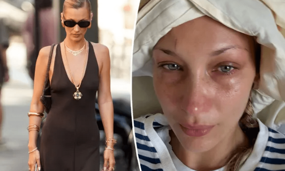 Bella Hadid đau đớn, tàn tạ không nhận ra khi bệnh nặng tái phát 