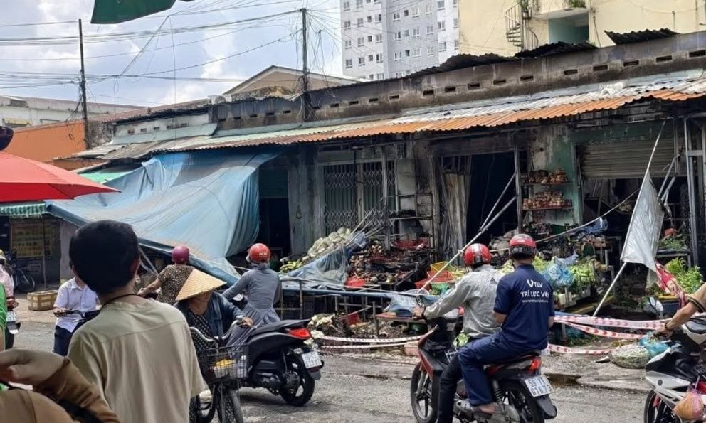 Vụ cháy ki-ốt rau củ ở TP.HCM: Bố mẹ lần lượt qua đời, con trai 16 tuổi chuẩn bị được phẫu thuật ghép da 2 tay 2 chân