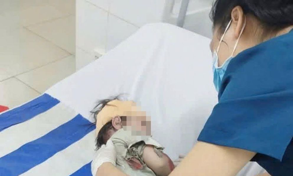 Tình trạng của bé gái 32 tháng tuổi sống sót trong vụ tai nạn khiến 3 người tử vong ở Đồng Nai