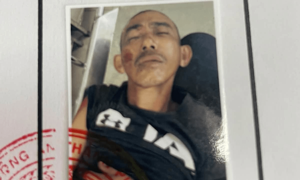 Phát hiện người đàn ông chấn thương ngồi thẫn thờ bên lề đường: Công an phát thông báo khẩn tìm người thân