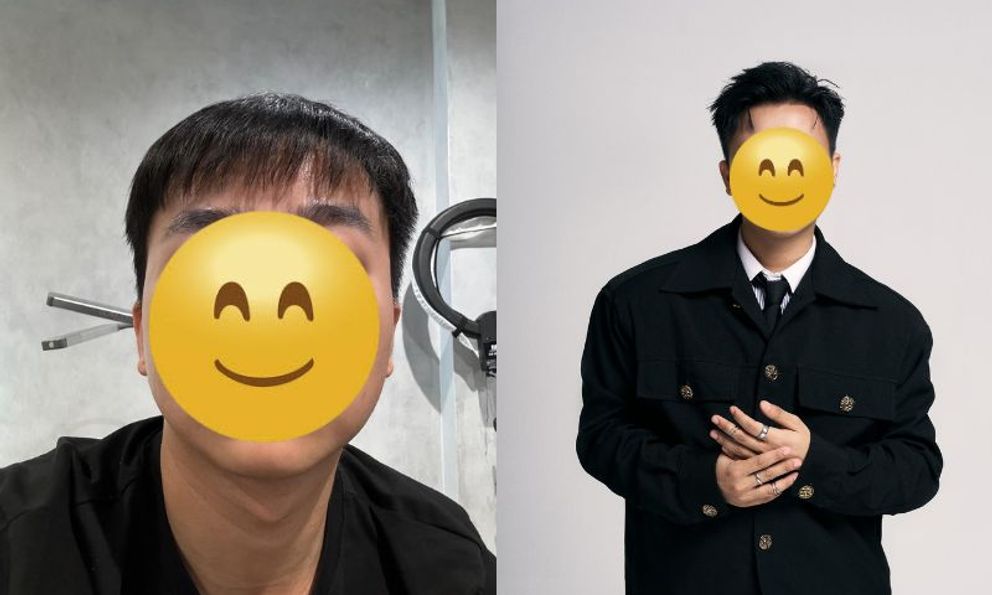 Ngay giáp Tết, 1 sao nam Vbiz đi làm đẹp, kết quả thế nào mà khiến cả showbiz 