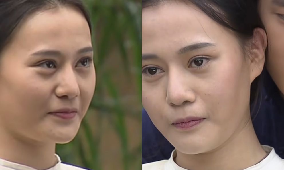 Đoạn clip trước khi thẩm mỹ của phú bà Việt viral trở lại, gương mặt lộ rõ khuyết điểm