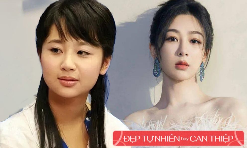 Chỉ mất hơn 20 phút, Dương Tử đã biến đổi gương mặt tròn thành trái xoan 