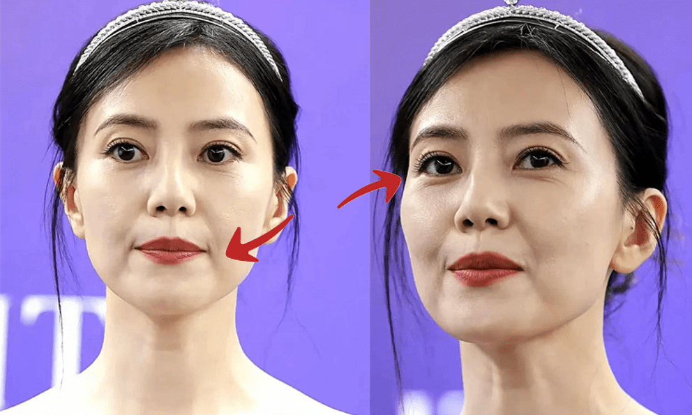 Ở tuổi 45, Cao Viên Viên lộ rõ nếp nhăn nơi khóe mắt, gương mặt hơi chảy xệ, 