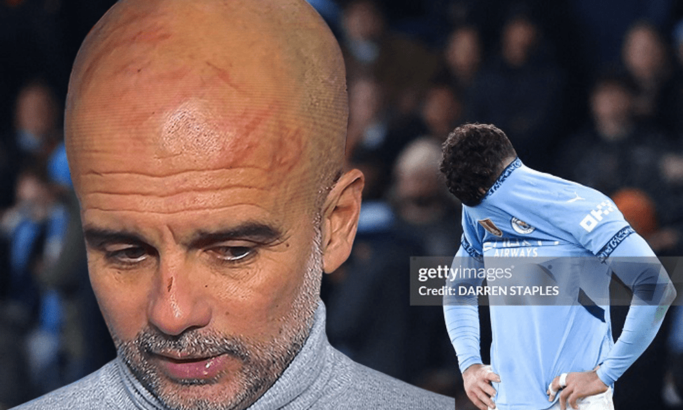 Sốc: HLV Pep Guardiola tự hành hạ bản thân, trầy xước khắp mặt vì trận hòa cay đắng