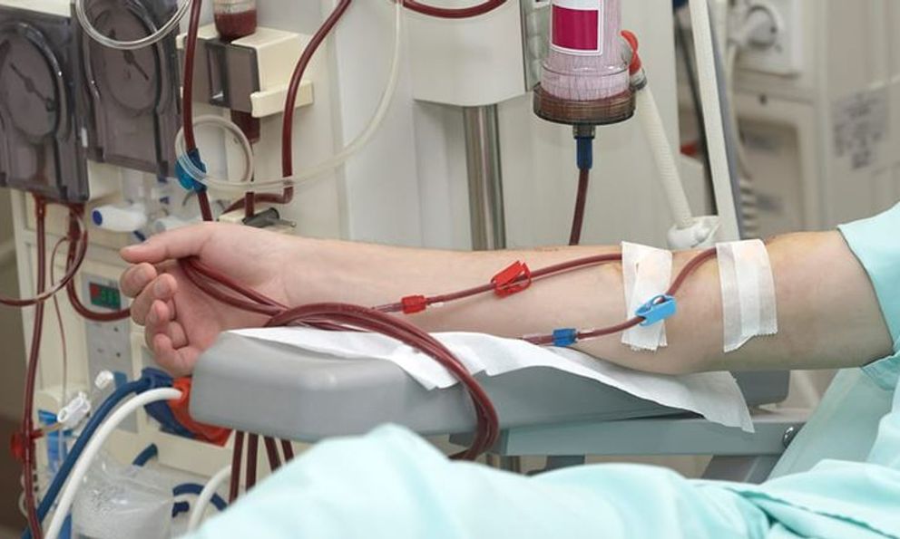 Kỹ sư 26 tuổi sốc khi phát hiện suy thận độ 4, bác sĩ nói rất có thể là do ăn uống kiểu này