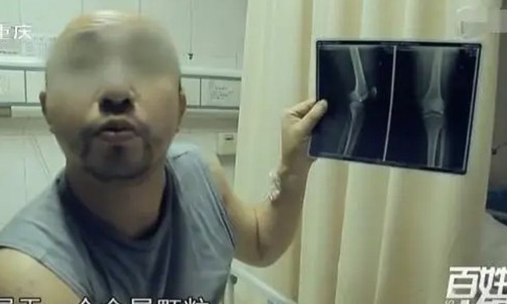 Nửa đêm đau nhói ở gối, người đàn ông phải nhập viện liền được bác sĩ yêu cầu: Gọi cảnh sát ngay lập tức!