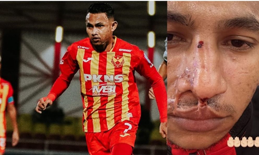 Hết bị tạt axit, đối thủ của tuyển Việt Nam lại bị gãy mũi vì sự cố bất ngờ