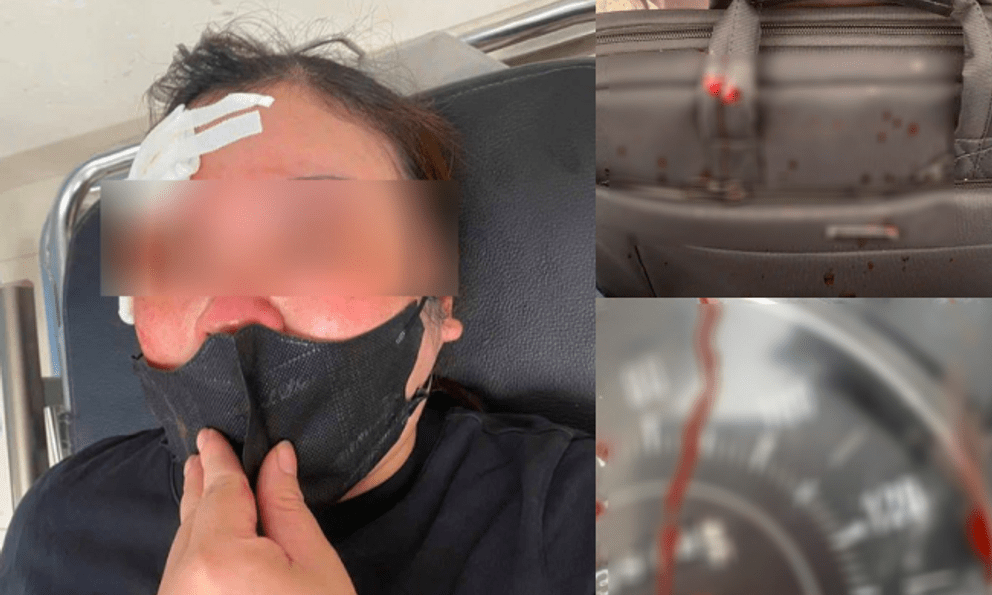 Dừng xe nghe điện thoại, người phụ nữ bị đánh giữa phố Hà Nội bằng gậy sắt: Nguyên nhân được tiết lộ