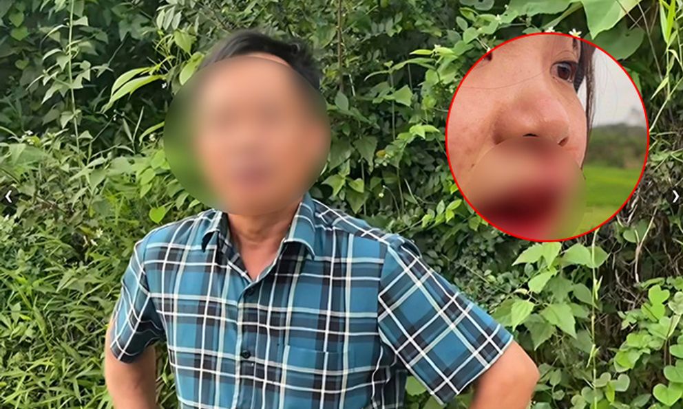 Vụ cô gái tố tài xế ô tô hành hung chảy máu mồm: Người đánh là cán bộ xã