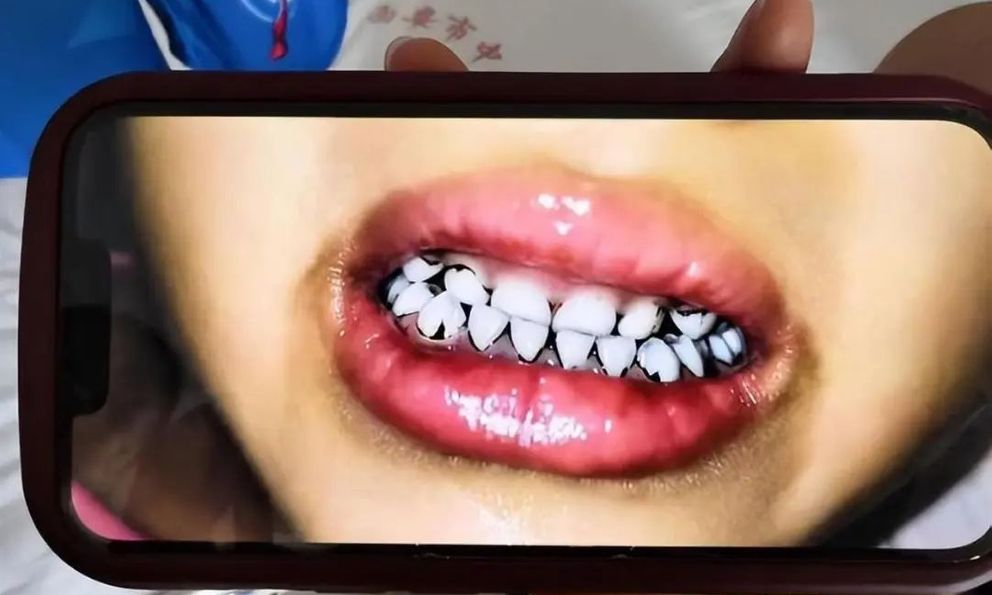 233 trẻ mầm non ở Thiên Thủy nhiễm độc chì nặng: Lộ tẩy sự thật kinh hoàng về nguyên liệu làm bánh