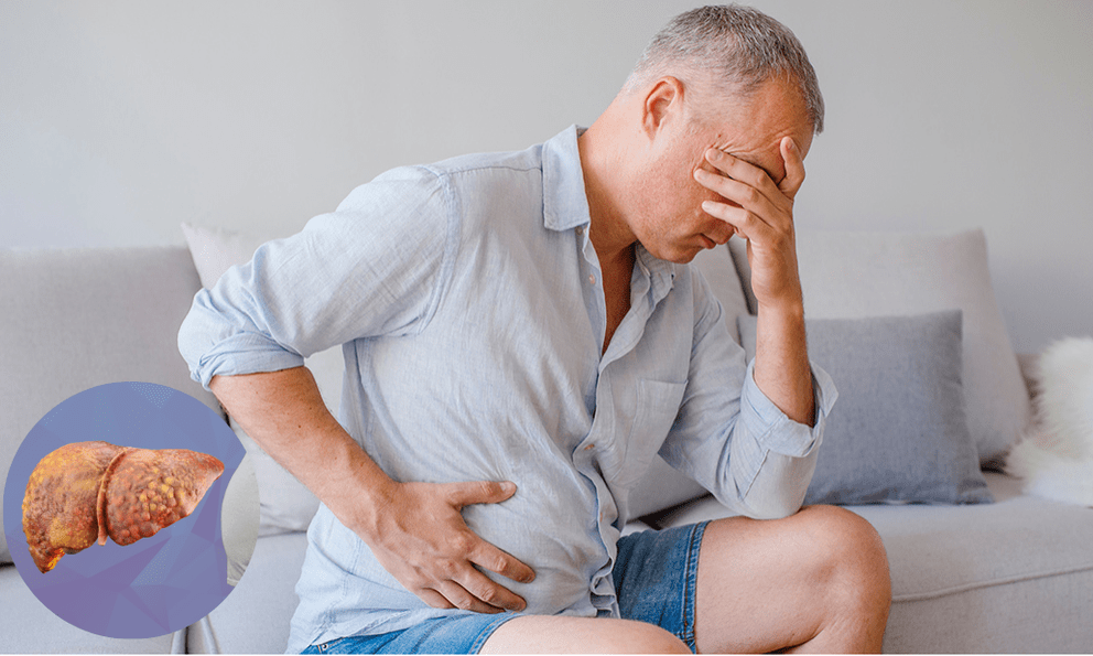 Mắc gan nhiễm mỡ sau 6 tháng ăn kiểu này: Bác sĩ thốt lên “đây là sai lầm cực tai hại