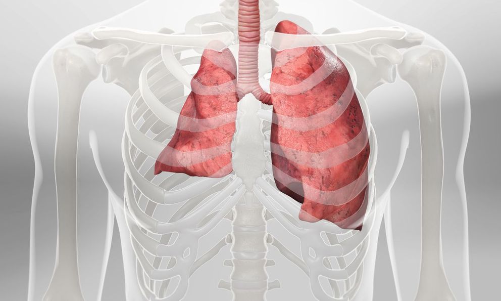 Đang khỏe mạnh bỗng bị xẹp phổi, thanh niên 24 tuổi hối hận vì đã làm 1 điều suốt gần 10 năm