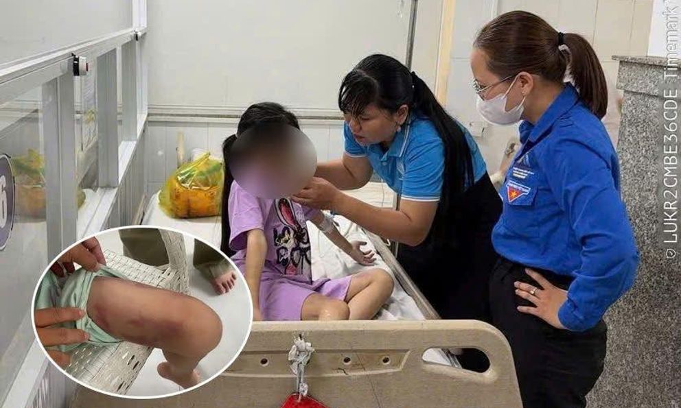 Mẹ ruột và người tình 19 tuổi thay nhau bạo hành dã man con gái 9 tuổi