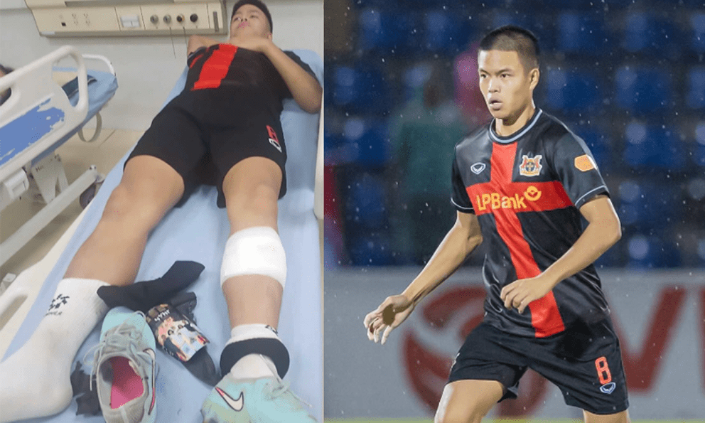 Cầu thủ Việt kiều giá 12 tỷ đồng phải nhập viện gấp sau khi lãnh trọn cú đạp tại trận đấu V.League