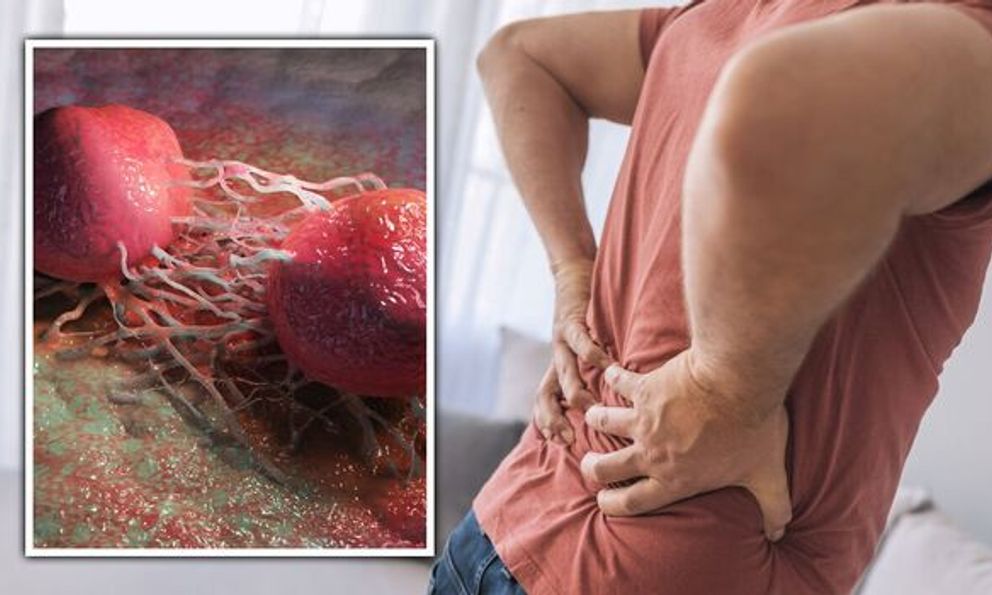 Ngày càng nhiều nam giới mắc ung thư tuyến tiền liệt: Thấy những dấu hiệu này thì làm ơn đừng bỏ qua