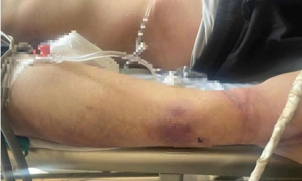 Sau khi thiếu niên tử vong: Trung tâm CTXH đã đưa khoảng 80 học viên lên 3 ô tô, chở đi nhiều nơi 