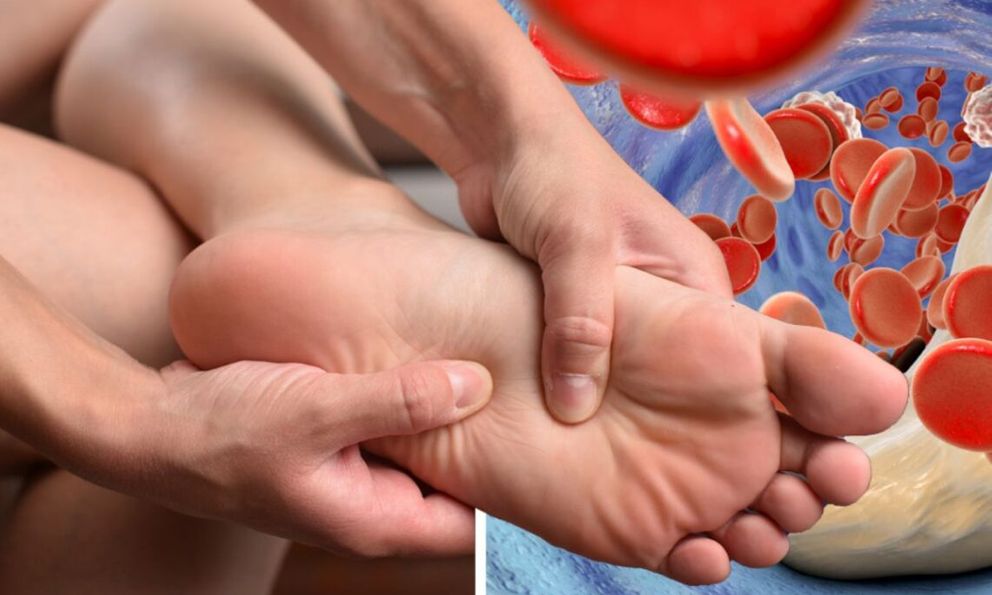 6 loại thực phẩm nếu ăn quá nhiều sẽ khiến axit uric trong máu tăng cao, 