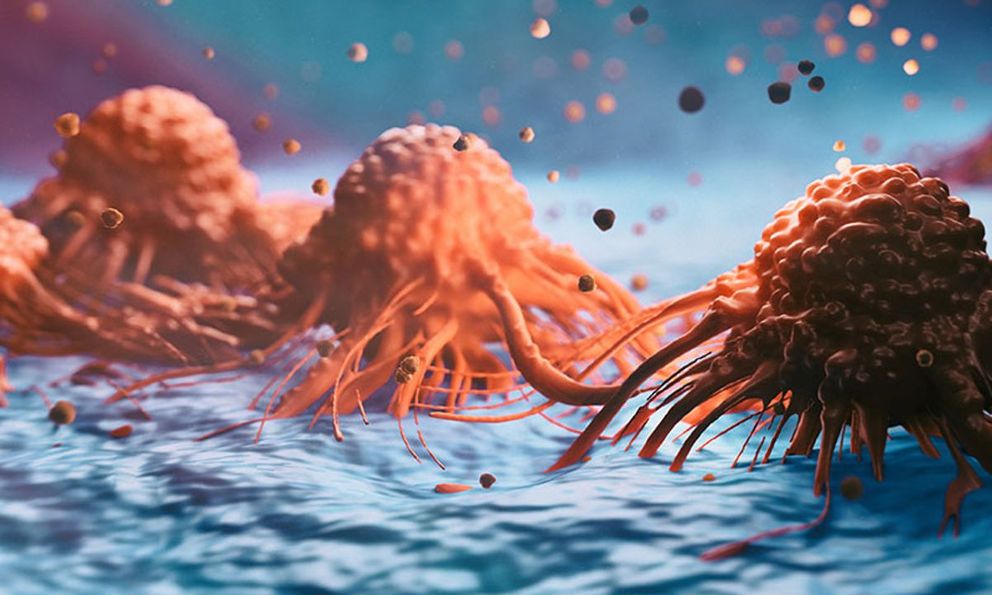 Những người dưới 50 tuổi chú ý: 6 triệu chứng này có thể là dấu hiệu của ung thư