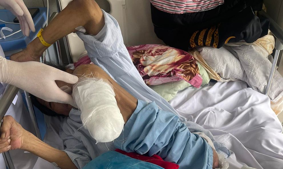 Người đàn ông hoại tử chân, viêm loét triền miên ở tuổi 62: Bác sĩ chỉ rõ 4 “thủ phạm” phá hủy mạch máu