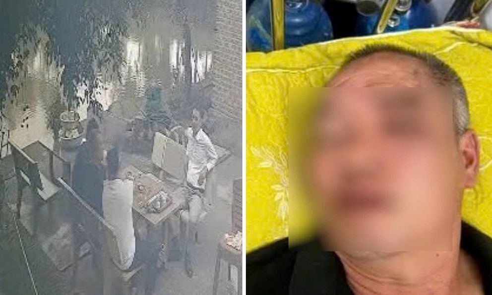 Chủ quán ăn ở Hải Phòng bị khách đánh tím mắt: Hé lộ nguồn cơn bất ngờ