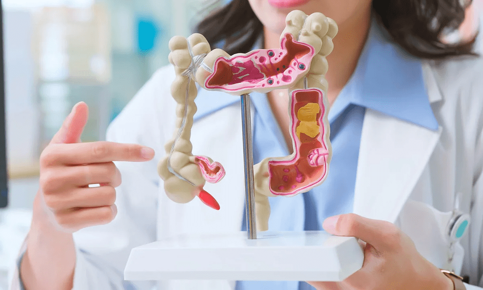 Ung thư đại trực tràng gia tăng ở người trẻ: Đây là 11 cách phòng ngừa, bạn làm được mấy?